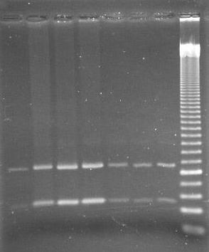 Figura 11. Representação dos tamanhos dos fragmentos obtidos na PCR-RFLP para a detecção da mutação p.y250x no gene TFR2. 282 pb marcador de 50 pb 123 pb Figura 12.