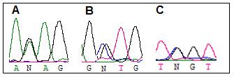 Figura 16. A: heterozigose para a mutação HJV p.e302k.