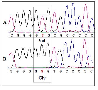 C: heterozigose para a variante intrônica HJV IVS1-36C>G. Figura 17.