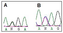 A: sequência do paciente com hemocromatose juvenil, B: sequência do controle.