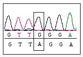 Figura 19. A: heterozigose para o polimorfismo TFR2 p.a75v. B: heterozigose para o polimorfismo TFR2 p.a617a.