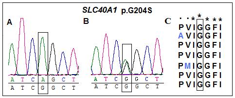 Figura 21. A: homozigose para a mutação SLC40A1 p.g204s 