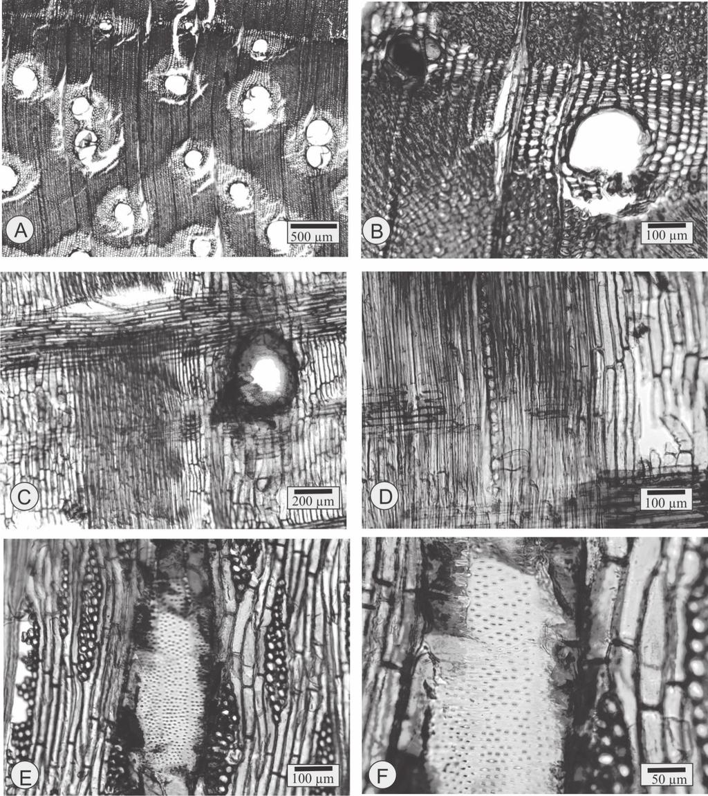 FIGURA 1 Fotomicrografias do lenho de Enterolobium glaziovii. A Porosidade difusa, poros solitários, em múltiplos radiais, e parênquima paratraqueal confluente e marginal (seção transversal).