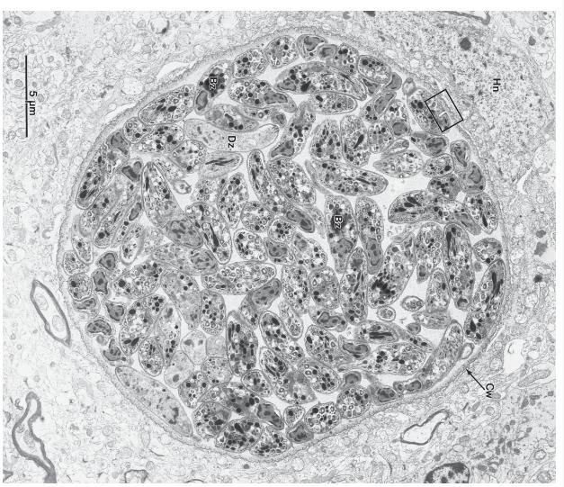 24 FIGURA 4. Cisto de Toxoplasma gondii em tecido nervoso de camundongo, repleto de bradizoítos (65).