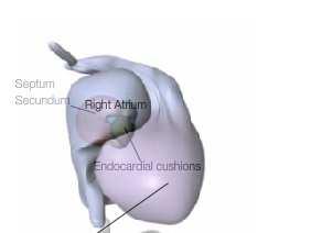 O septum primum se forma no dorso do coração e funde com o coxim Visão ventral do coxim endocárdico Visão lateral Dir do coxim endocárdico http://pie.