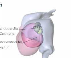 septo interventricular