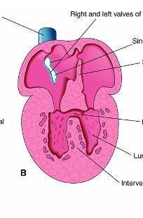 interventricular 5 semanas