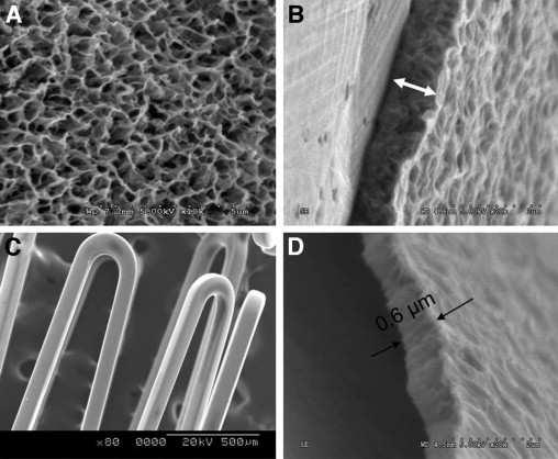 20 Figura 1 - Componentes principais do stent VestaSync.