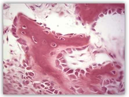 Osteoblastos (Ob) são células jovens que apresentam a capacidade de produzir a parte orgânica da matriz óssea e de promover sua posterior mineralização.