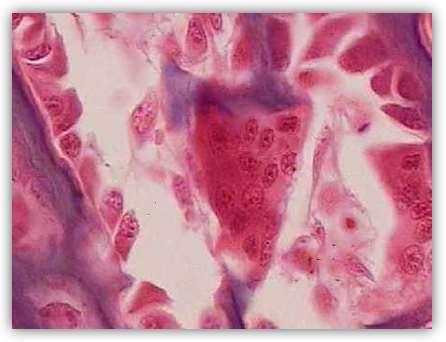 Tecido Ósseo Primário Osteoclastos são células globosas, gigantes e polinucleadas, que aparecem nas superfícies das trabéculas