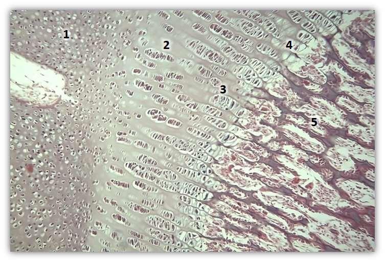 1 2 3 4 5 Ossificação Endocondral 1. Zona de cartilagem em repouso ou de cartilagem hialina; 2.