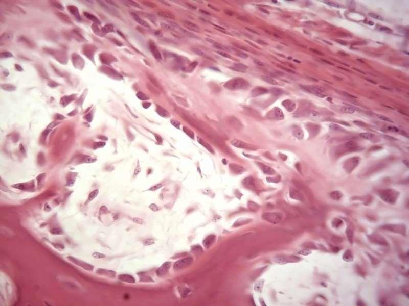 Ossificação Intramembranosa Tecido osteogênico Em algumas espículas, observa-se uma faixa periférica estreita, que é formada por matriz ainda não calcificada, denominada osteoide.