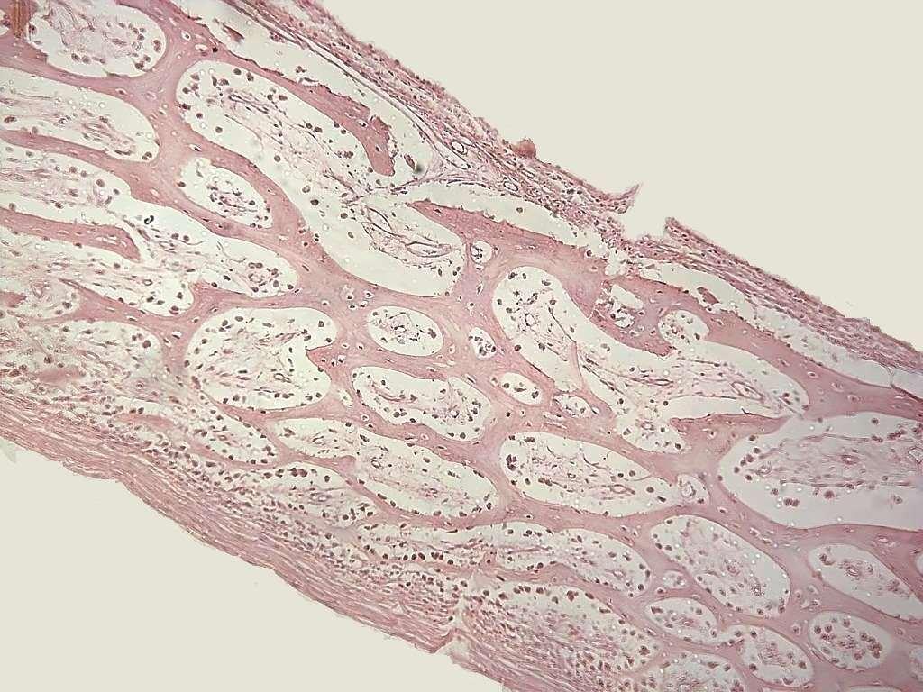 Ossificação Intramembranosa Tecido osteogênico Periósteo HE,