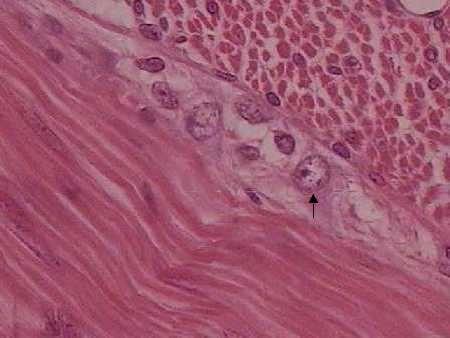 Plexo Mioentérico SNA Músculo liso (transversal)