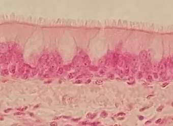 Tecido epitelial de revestimento pseudo-estratificado cilíndrico ciliado com células caliciformes cílios Células cilíndricas ciliadas Células caliciformes
