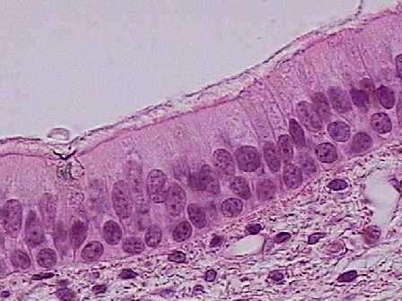 Núcleos Tecido conjuntivo Cilios Cilios Célula caliciforme Núcleos Núcleos HE,