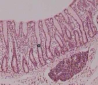 Entre as células que formam o epitélio secretor da glândula há muitas células caliciformes.