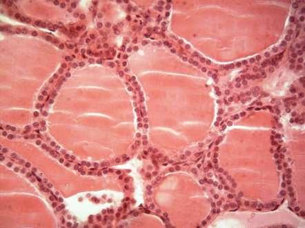 2.7 TECIDO EPITELIAL GLANDULAR ENDÓCRINO FOLICULAR OU VESICULAR (TIREÓIDE) A tireoide é uma glândula endócrina vesicular ou folicular, as células secretoras formam a parede de F estruturas esféricas,
