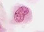 1.1.2 MACRÓFAGOS Os macrófagos são células conjuntivas com grande capacidade fagocitária.