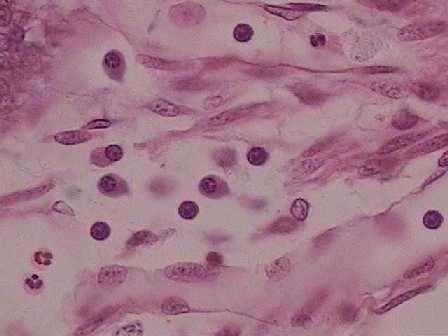 Macrófago (M) Fibroblasto (F)