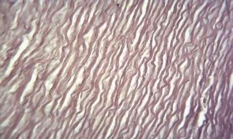 1.3 FIBRAS ELÁSTICAS As fibras elásticas são encontradas na parede das artérias de grande calibre como a Aorta, formando