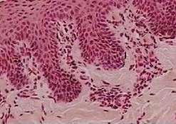 1.5 TECIDO CONJUNTIVO FROUXO O tecido conjuntivo frouxo apresenta todos os elementos estruturais típicos do tecido conjuntivo: células, fibras e substância fundamental amorfa, não havendo, nenhuma