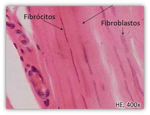 Entre os feixes de fibras colágenas, notam-se fibroblastos dispostos em fileiras paralelas.