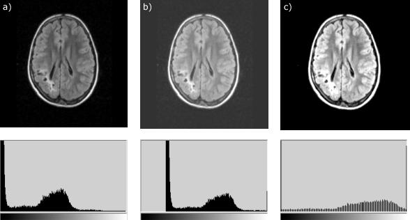 Figura 5: Imagem de exame de tomografia axial de cabeça humana. (a) imagem original, (b) imagem com o brilho alterado e (c) imagem com o contraste alterado.