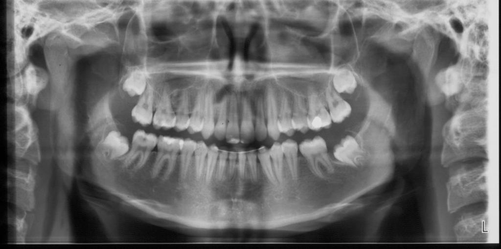 molares (Figura 11).