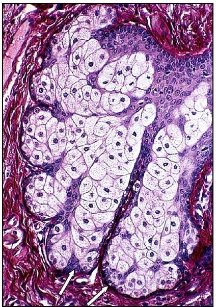 Fotomicrografia das vilosidades intestinais com células caliciformes.