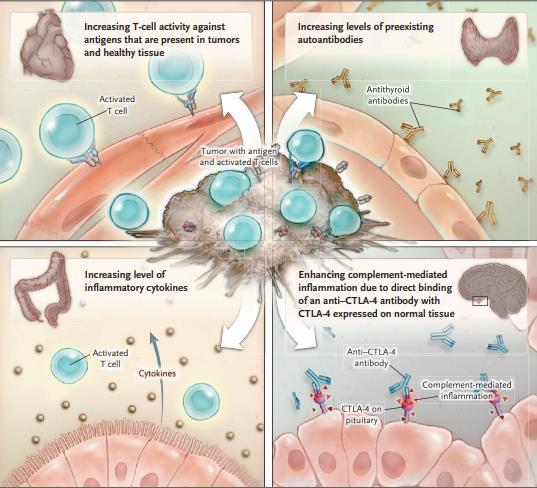 NEJM