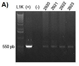 Após as reações foi feito eletroforese em gel de agarose com brometo de etídio, para a análise em luz UV da presença de fragmentos da sequência específica de interesse de DNA amplificados, qual foi