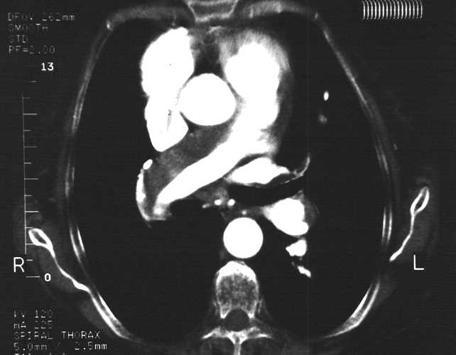 vascular 2b 