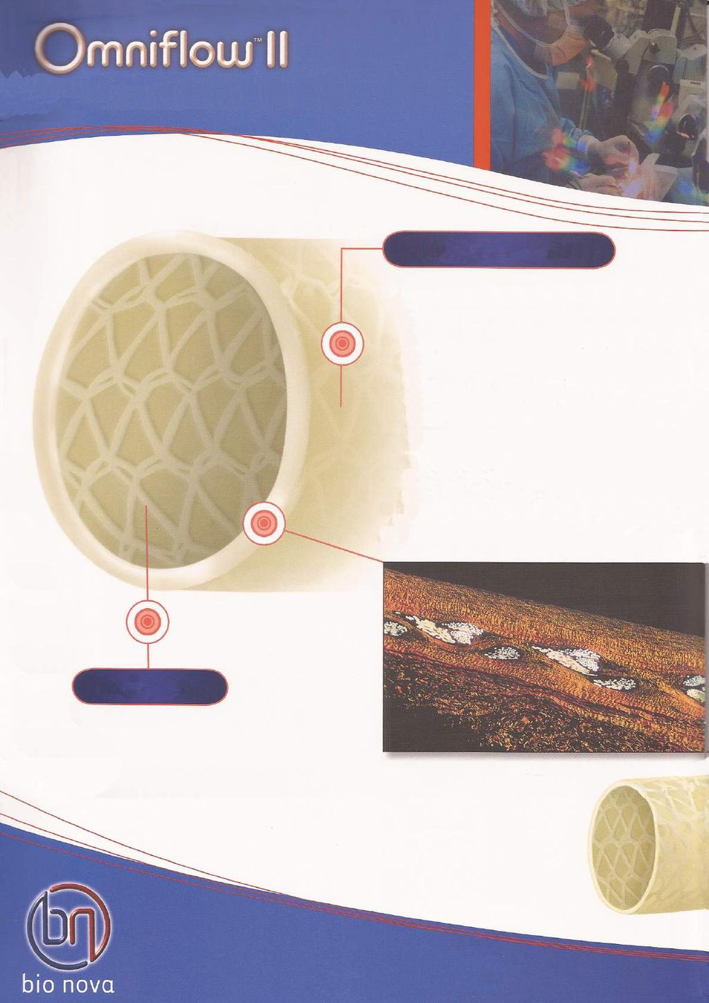 A Solução Biosintética Composição da estrutura Omniflow é uma composição de ligamento cruzado de colágeno ovino e um endoesqueleto de malha de poliéster.