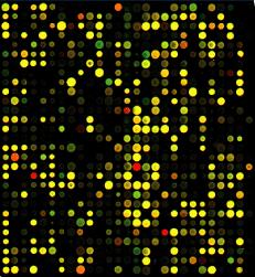 Microarranjos de DNA Fonte: http://en.wikipedia.org/wiki/dna microarray Mapeamento de QTL s Microarranjos de DNA Combinando microarranjos de DNA com mapeamento de QTL s cdna cor comp.
