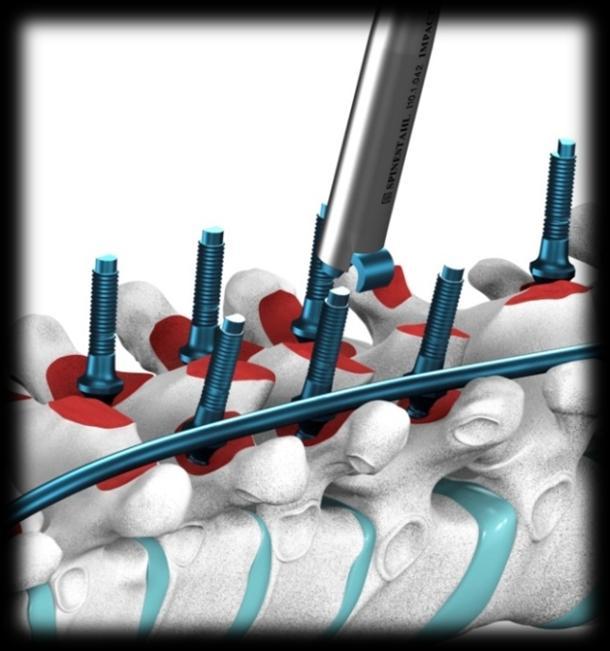 Fig. 34 Com o Clamp