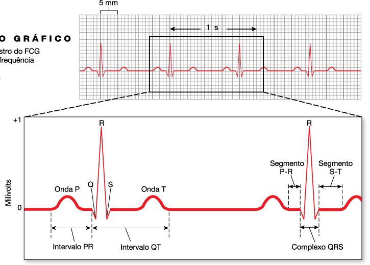 O ECG