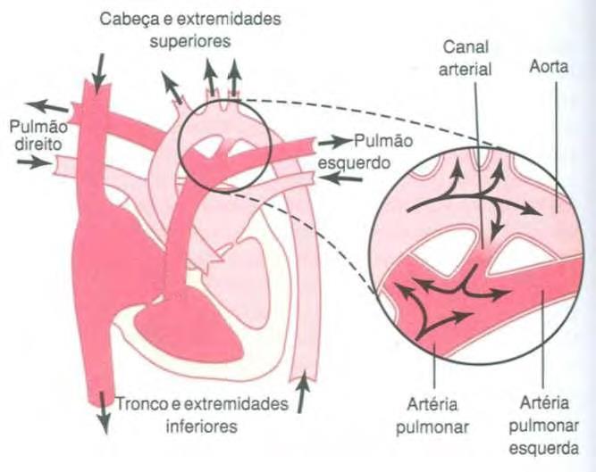 Persistência