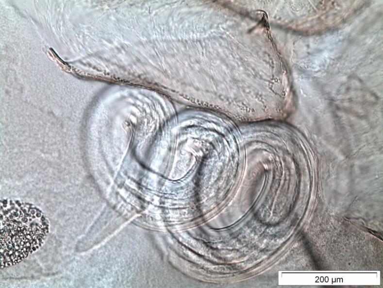 RESULTADOS Figura 29 P. perniciosus fêmea infetada com um nemátode, que se detetou nos 3 últimos segmentos abdominais, junto à espermateca, por observação ao microscópio ótico (fotografia de S.
