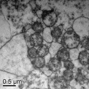 As células do cumulus não se expandiram, não foi observada a presença de espaço perivitelínico, os grânulos corticais se organizaram em grumos localizados no interior do