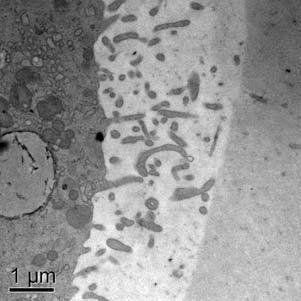 c) grânulos corticais isolados (setas) e alinhados à membrana plasmática e