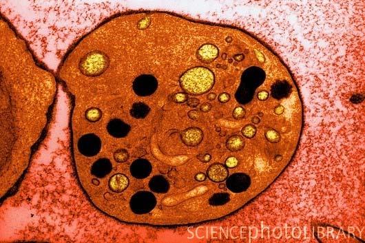 Figura 3: Micrografia de transmissão eletrônica (TEM) de uma plaqueta em repouso seccionada, exibindo as organelas. Fonte: Science Photo Library (48).
