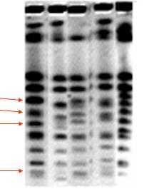 CARIOTIPAGEM Eletroforese em campo pulsado Separação eletroforética dos cromossomos das leveduras Linhagens de S.