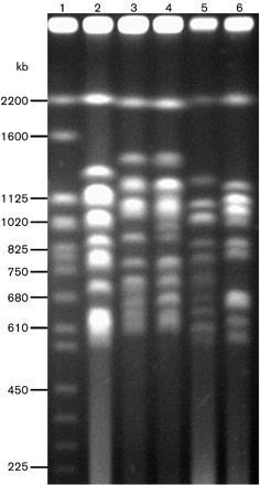 Electrophoretic karyotypes. Lanes: 1, S. cerevisiae YNN 295; 2, K.