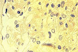 10 µm permanganato