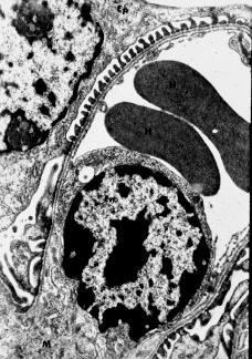 Podocyte capillary Podocyte urinary