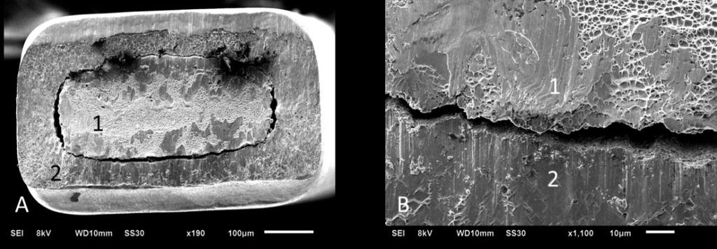 Figure 1. Scanning Electron Microscopy of NiTi/beta-titanium (magnification of 190x and 1100x). (1) Beta-titanium alloy; (2) nickel-titanium alloy 9. Figure 2.