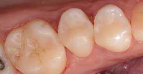 dentes naturais Fonte: Dr.