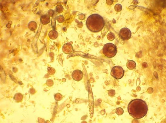 (2012), que obtiveram 100% das amostras positivas com a fita de acetato em animais com sarna demodécica, o que significa que essa é uma técnica eficaz para o diagnóstico dessa enfermidade.