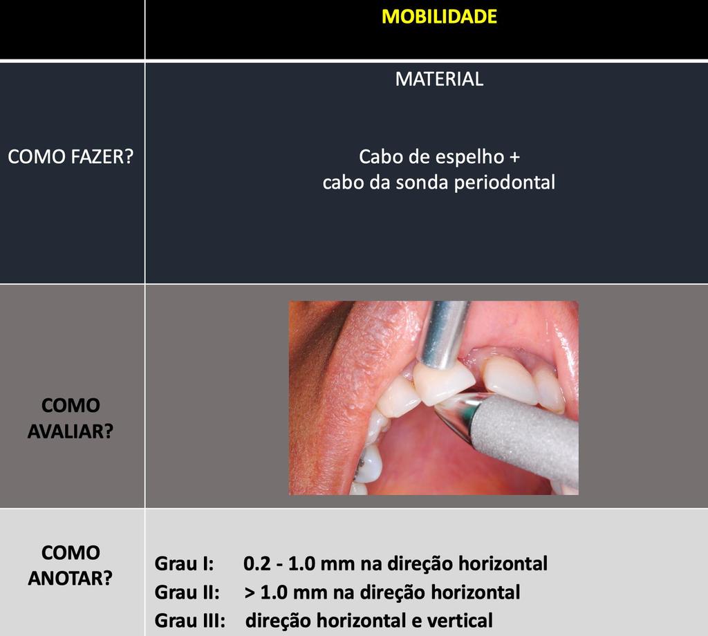 2.7 Determinação da complexidade da periodontite: mobilidade 2.